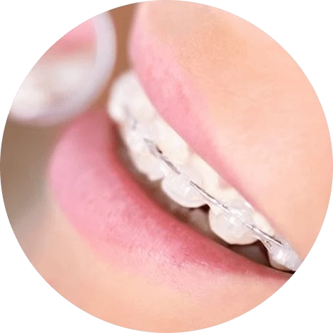 Баннер Поставить брекеты Баннер Поставить брекеты