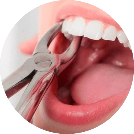 Баннер Удаление зуба Баннер Удаление зуба